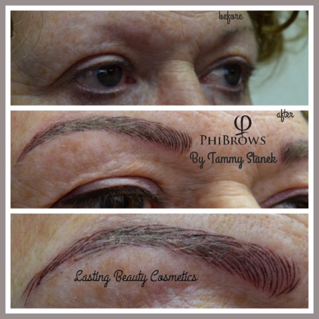 Microblading Permanent eyebrows for alopecia